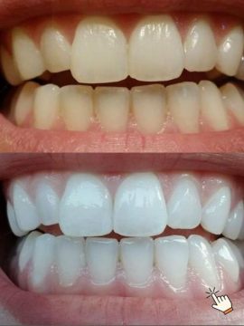 Teeth Whitening & Smile Care 3